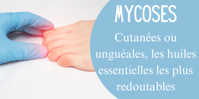 Mycoses cutanées ou unguéales, les huiles essentielles les plus redoutables